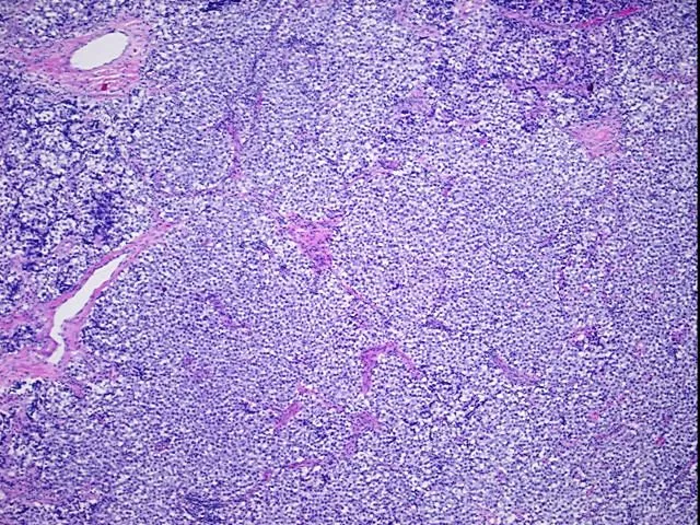 Tissue FFPE Sections, Testis - image 1