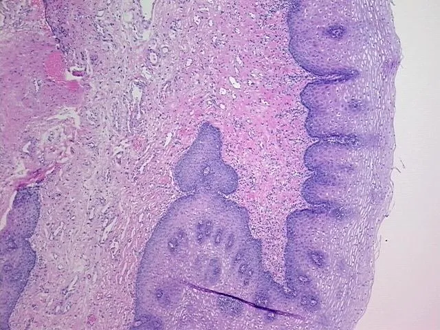 Tissue FFPE Sections, Esophagus - image 1