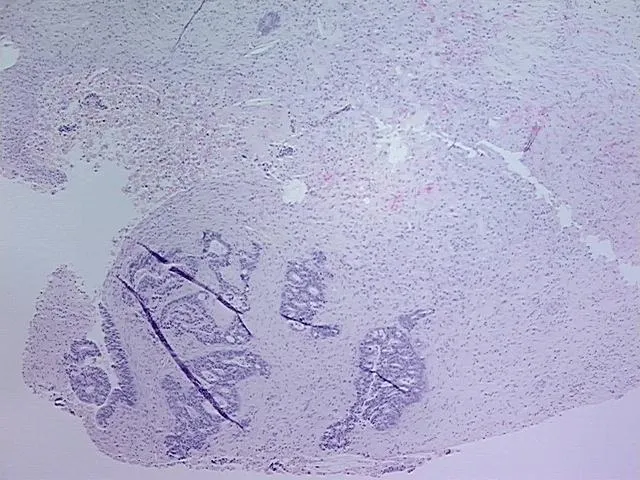 Tissue FFPE Sections, Gallbladder - image 1