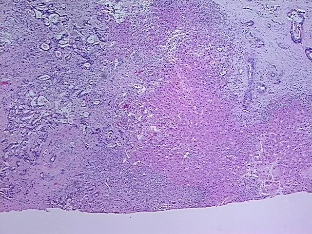 Tissue FFPE Sections, Gallbladder - image 1