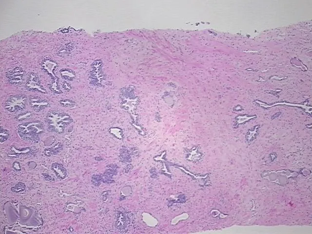 Tissue FFPE Sections, Prostate - image 1