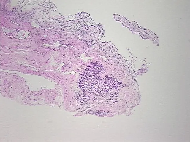 Tissue FFPE Sections, Nose - image 1