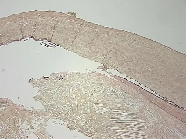 Tissue FFPE Sections, Aorta - image 1