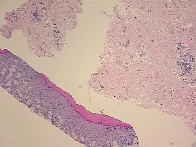 Tissue FFPE Sections, Vulva - image 1