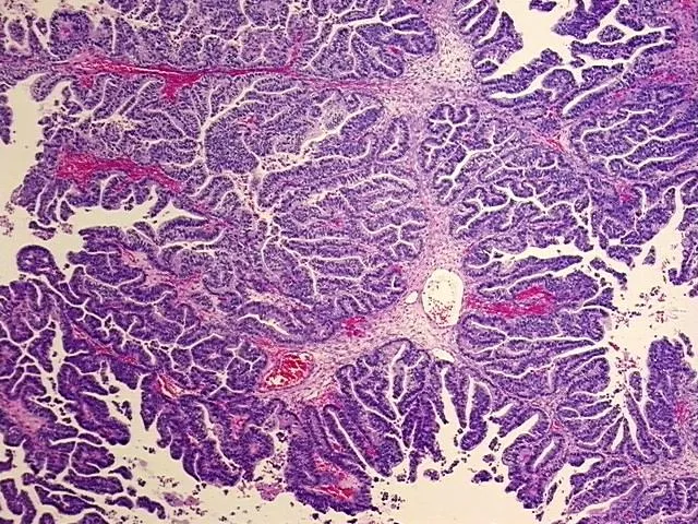 Tissue FFPE Sections, Cervix - image 1