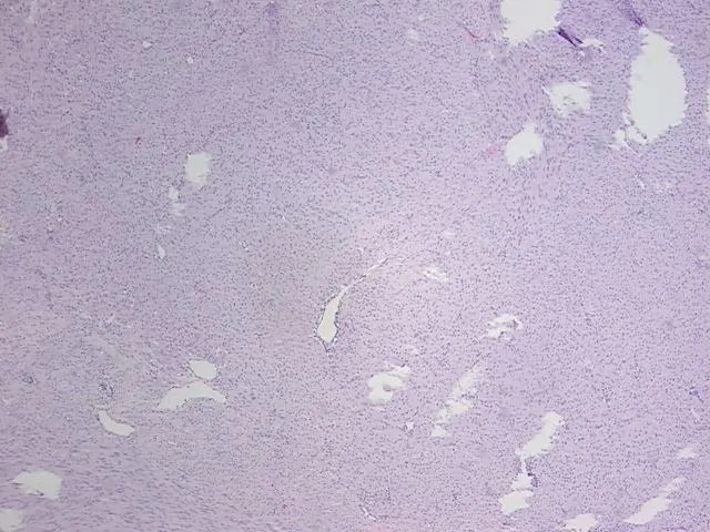 Tissue FFPE Sections, Duodenum - image 1