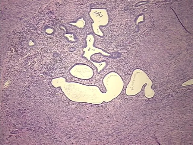 Tissue FFPE Sections, Uterus - image 1