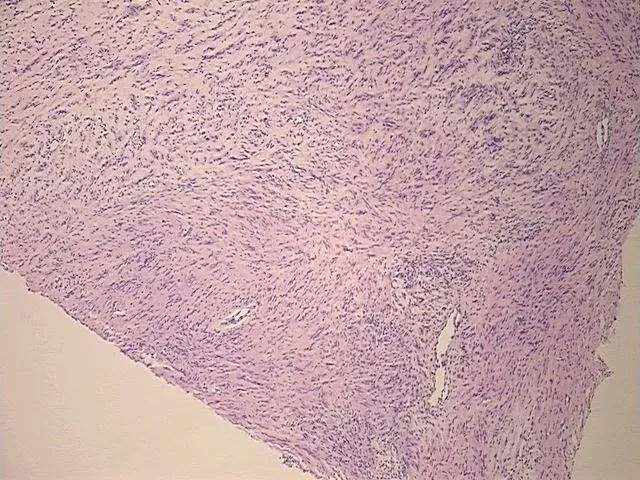 Tissue FFPE Sections, Peripheral nerve - image 1