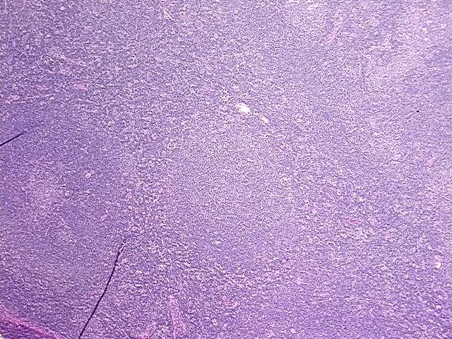 Tissue FFPE Sections, Lymphoid tissue - image 1
