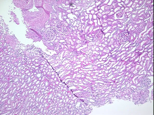 Tissue FFPE Sections, Kidney - image 1