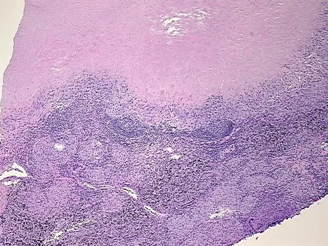 Tissue FFPE Sections, Lymph node - image 1
