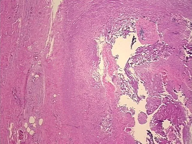 Tissue FFPE Sections, Urinary bladder - image 1