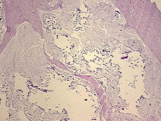 Tissue FFPE Sections, Esophagus - image 1