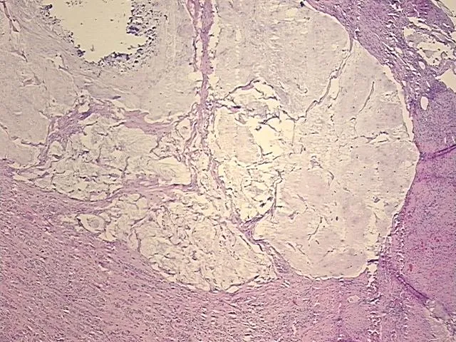 Tissue FFPE Sections, Esophagus - image 1