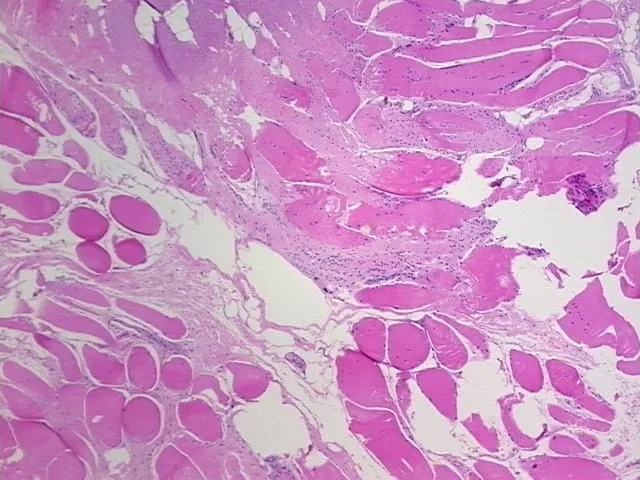 Tissue FFPE Sections, Muscle tissue - image 1