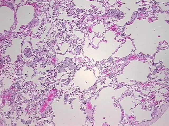 Tissue FFPE Sections, Lung - image 1