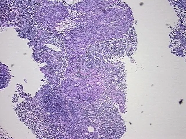 Tissue FFPE Sections, Cervix - image 1