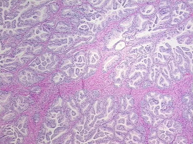 Tissue FFPE Sections, Prostate - image 1