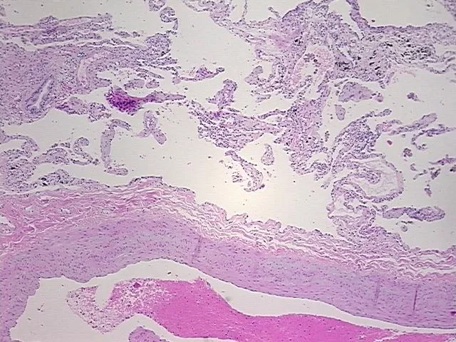 Tissue FFPE Sections, Lung - image 1