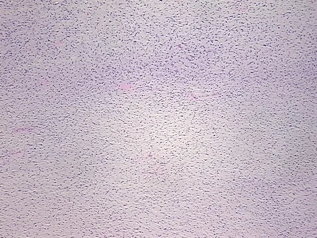 Tissue FFPE Sections, Soft tissue - image 1