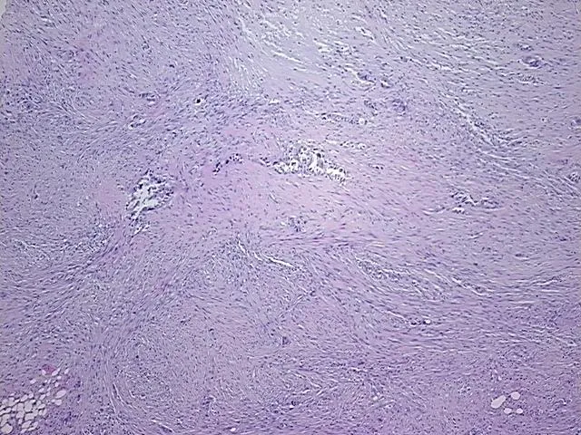 Tissue FFPE Sections, Endometrium - image 1