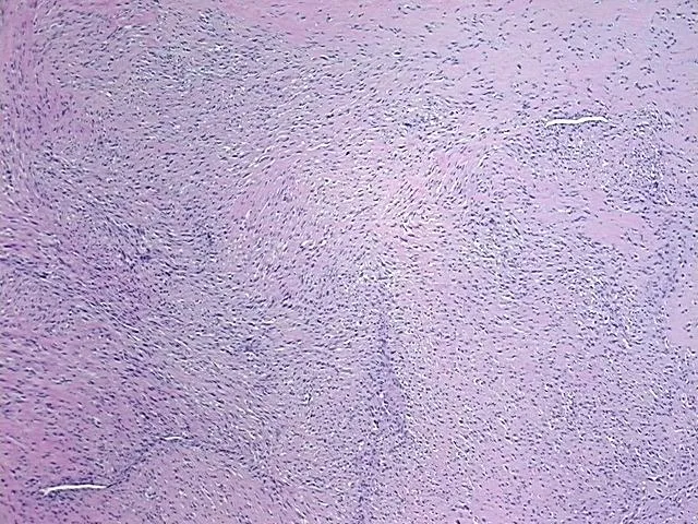 Tissue FFPE Sections, Soft tissue - image 1