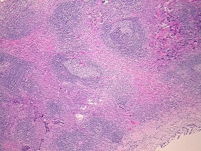 Tissue FFPE Sections, Lymphoid tissue - image 1