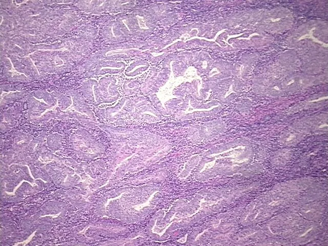 Tissue FFPE Sections, Endometrium - image 1