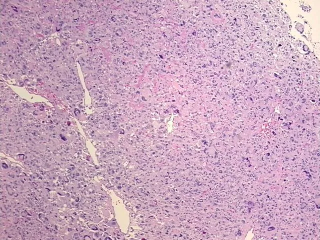 Tissue FFPE Sections, Soft tissue - image 1