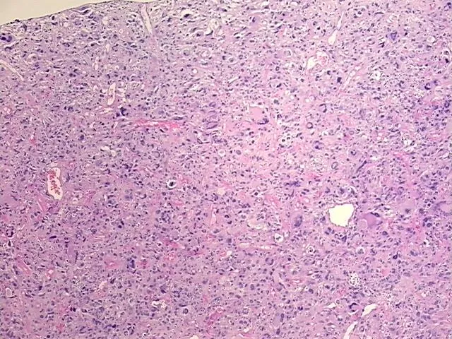 Tissue FFPE Sections, Soft tissue - image 1