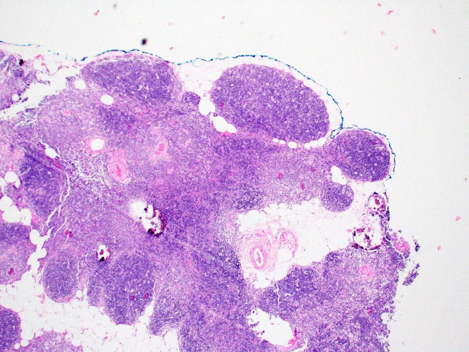 Tissue FFPE Sections, Thymus - image 1