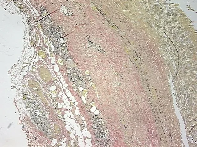 Tissue FFPE Sections, Aorta - image 1