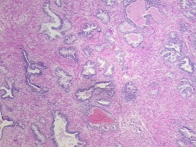 Tissue FFPE Sections, Prostate - image 1
