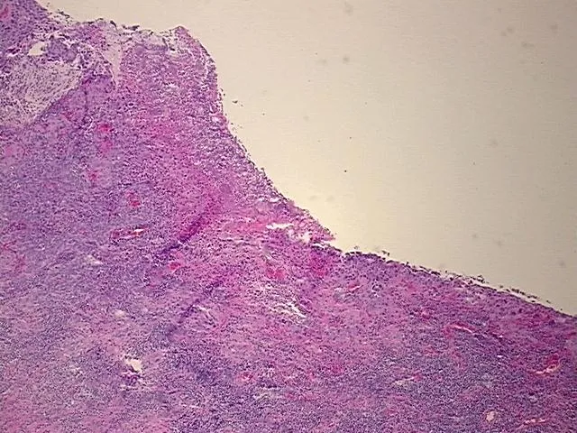 Tissue FFPE Sections, Cervix - image 1