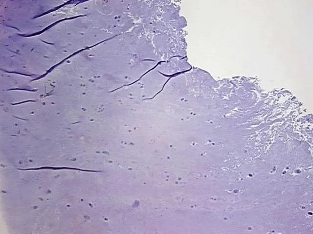 Tissue FFPE Sections, Intervertebral disc - image 1