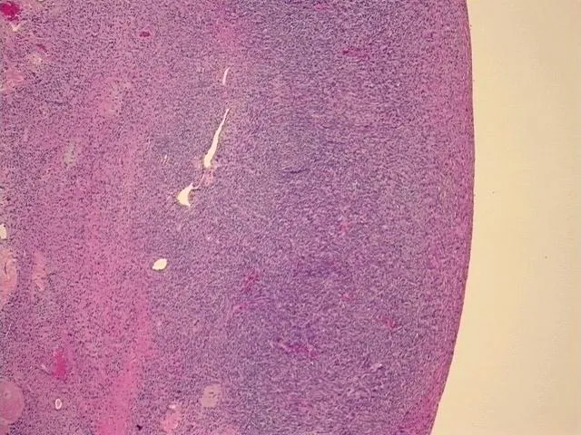 Tissue FFPE Sections, Ovary - image 1