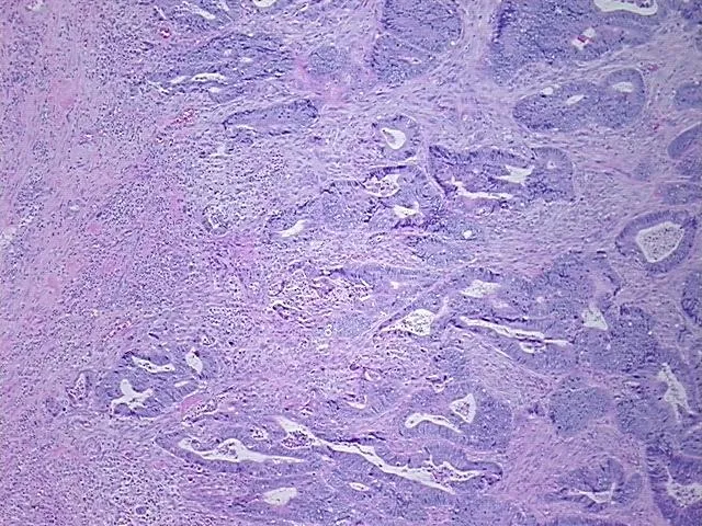 Tissue FFPE Sections, Rectum - image 1