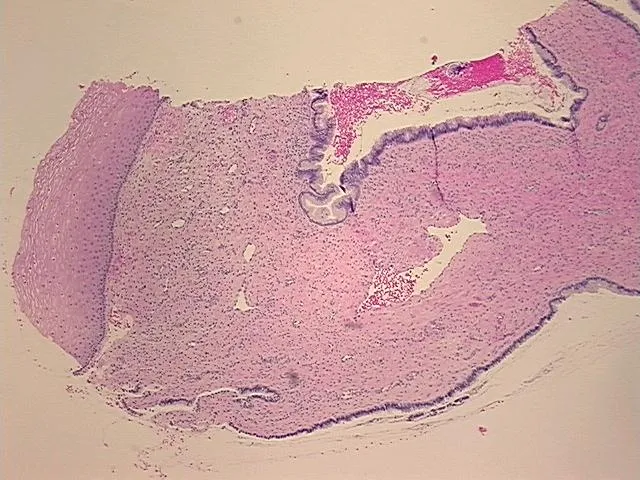 Tissue FFPE Sections, Cervix - image 1