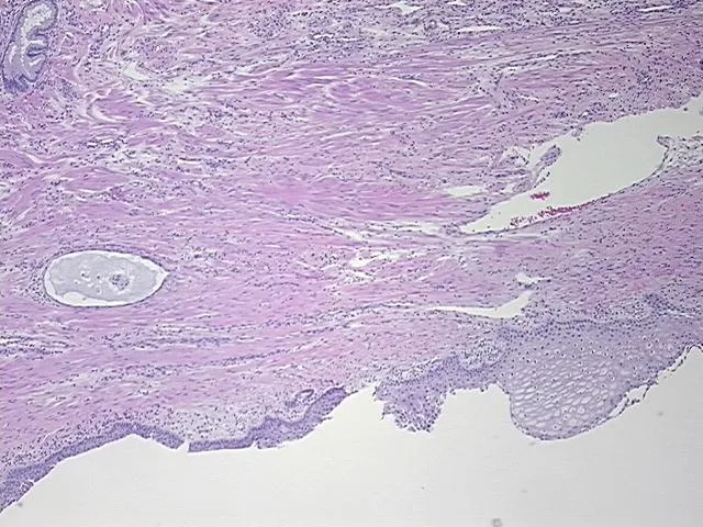 Tissue FFPE Sections, Cervix - image 1