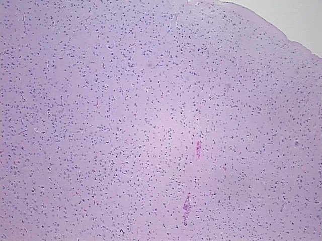 Tissue FFPE Sections, Brain - image 1