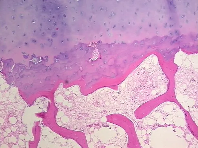 Tissue FFPE Sections, Joint - image 1