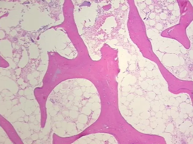 Tissue FFPE Sections, Joint - image 1