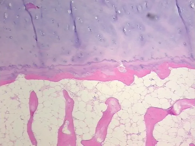 Tissue FFPE Sections, Joint - image 1