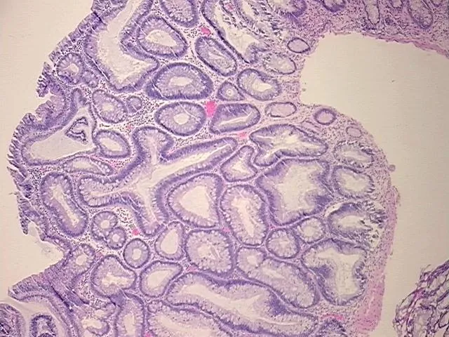 Tissue FFPE Sections, Rectum - image 1