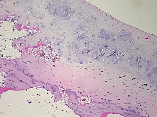 Tissue FFPE Sections, Bone - image 1