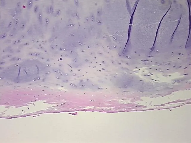 Tissue FFPE Sections, Bone - image 1
