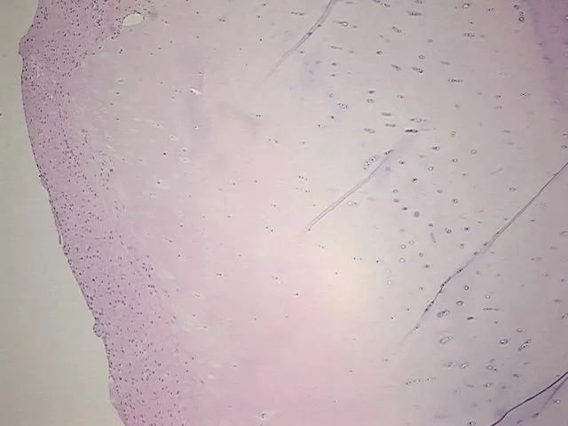 Tissue FFPE Sections, Joint - image 1