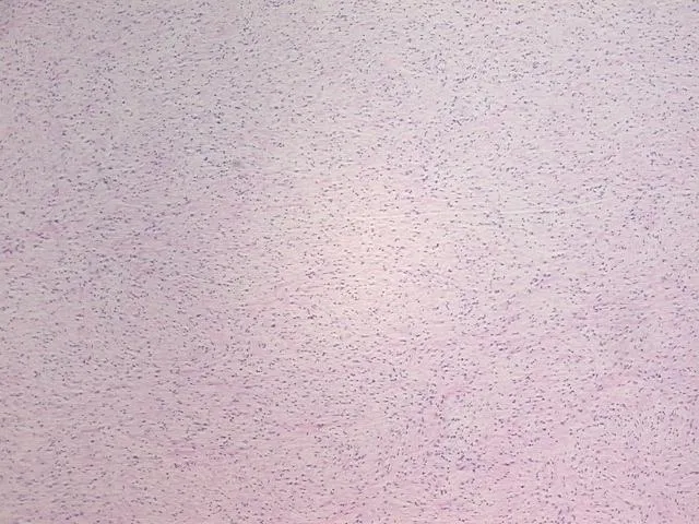 Tissue FFPE Sections, Peripheral nerve - image 1