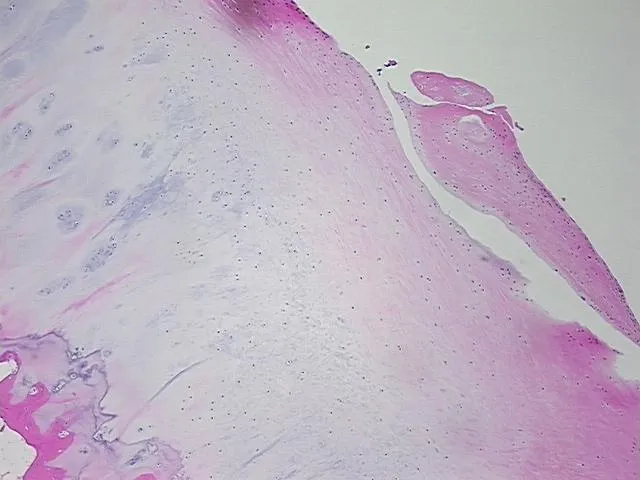 Tissue FFPE Sections, Bone - image 1