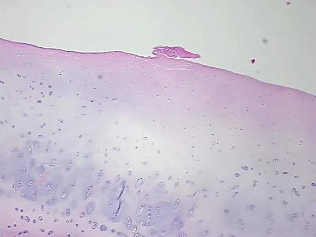 Tissue FFPE Sections, Bone - image 1